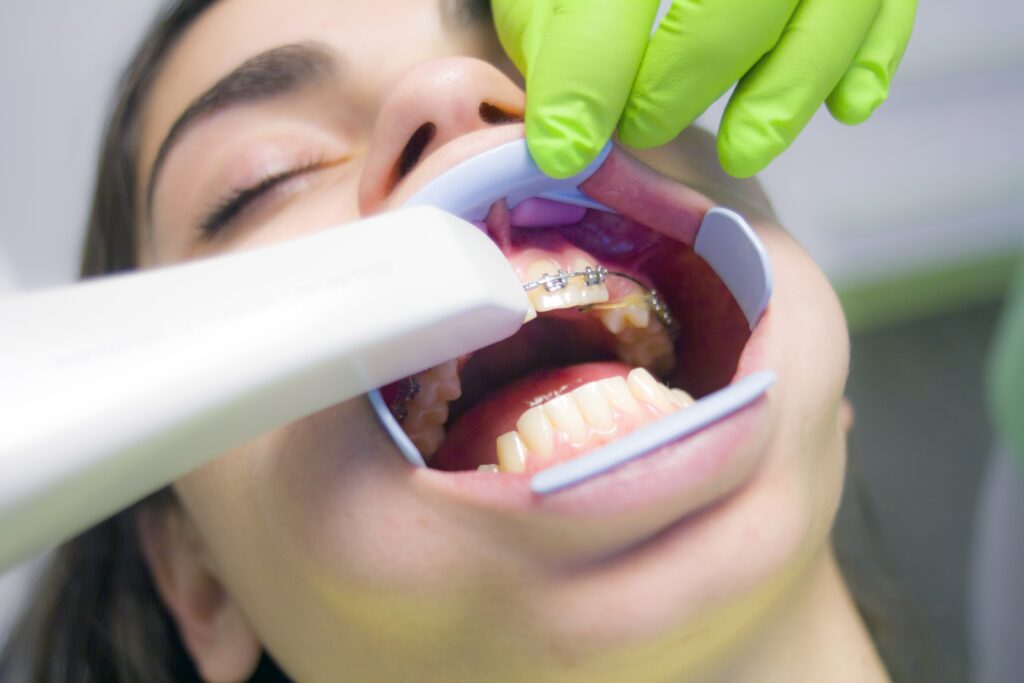 Orthodontic braces evaluation at Coit Dental, Frisco Texas